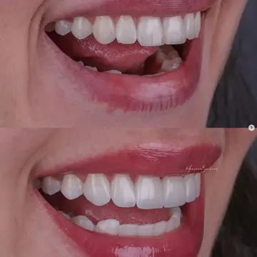 Publicação do Instagram sobre estética dental