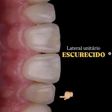 Publicação do Instagram sobre sorriso e estética